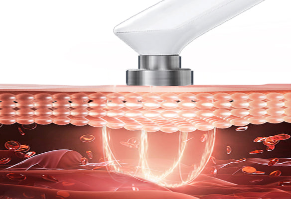 Mlay Immortal Beauty RF + EMS Anti-Cellulite Beauty Device RF02