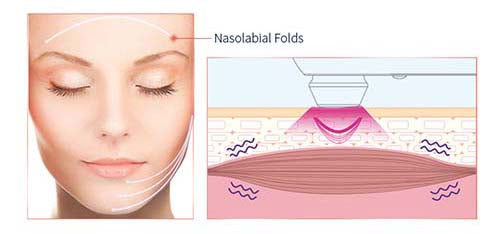 MLAY RF01 Desktop RF Beauty Device
