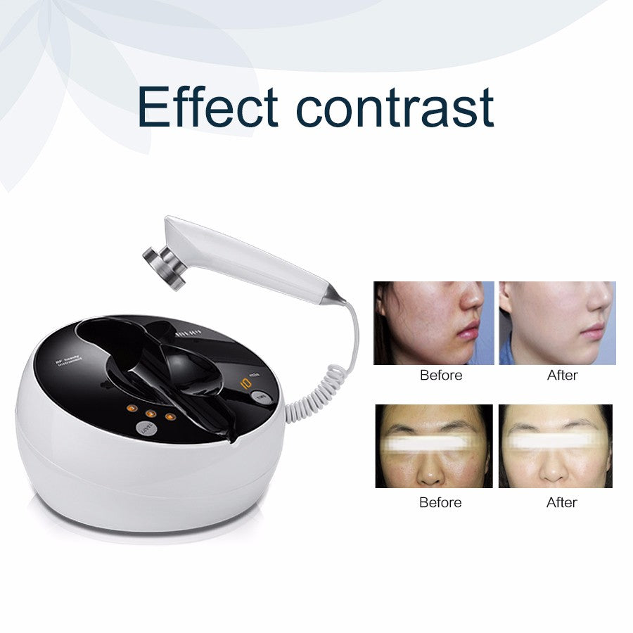MLAY RF01 Desktop RF Beauty Device