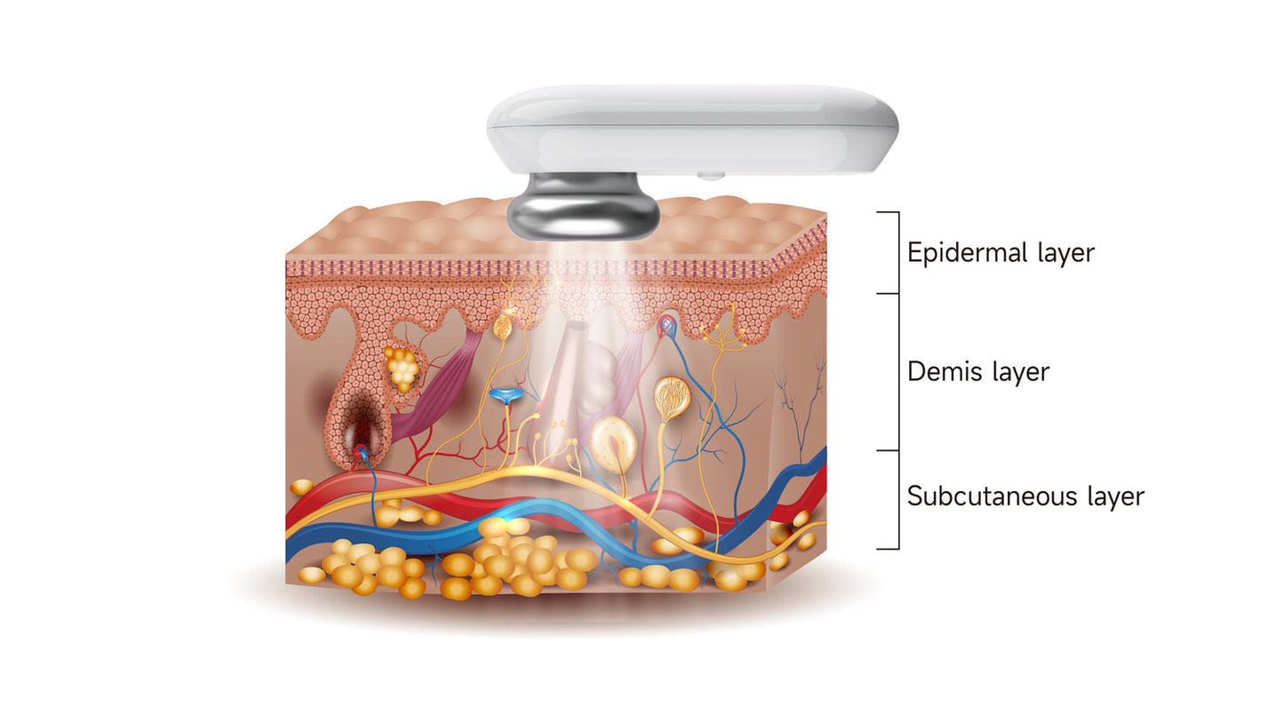 Mlay Immortal Beauty RF + EMS Anti-Cellulite Beauty Device RF02