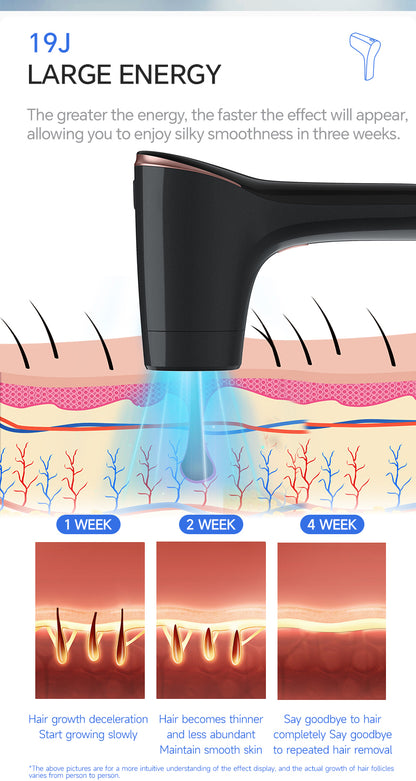 T19 Most Popular High Power Laser Ipl Epilator Skin Facial Hair Removal