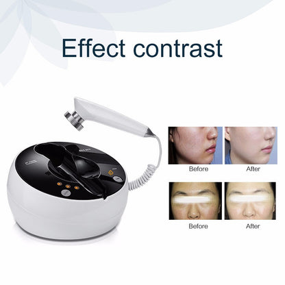 MLAY RF01  Desktop RF Beauty Device